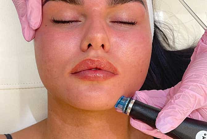 Hydrafacial Glow Treatment